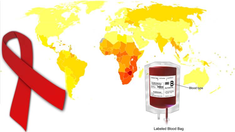 HIV, transfuzija i opasnost od homoseksualaca